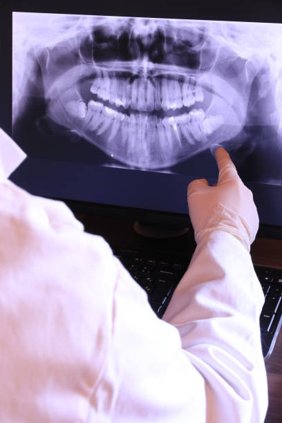 Best Emergency Wisdom Teeth Removal in Edgard, LA