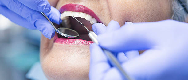 Best Emergency Wisdom Teeth Removal in Edgard, LA
