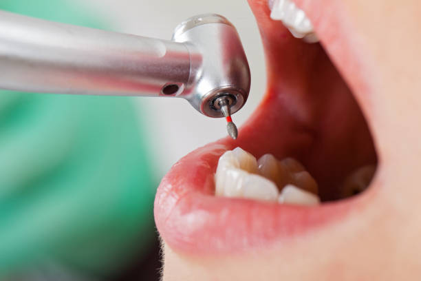Trusted LA Emergency Dentist Experts